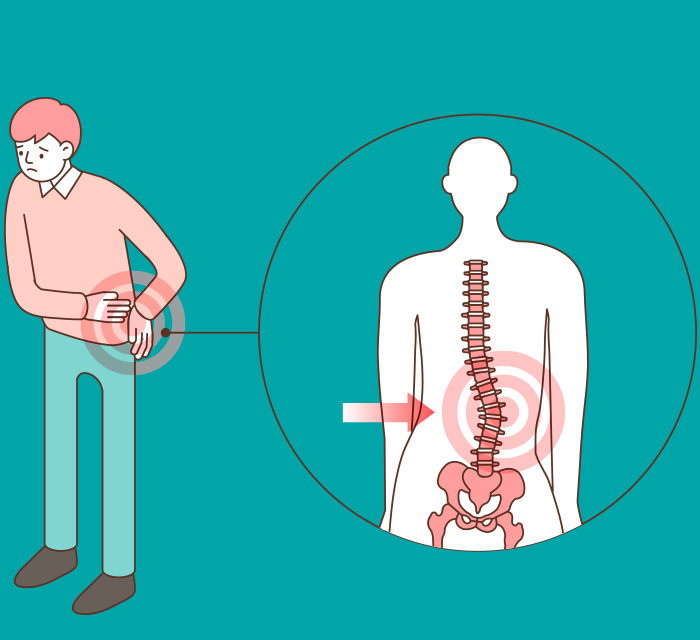 척추가 휘어있는 남성